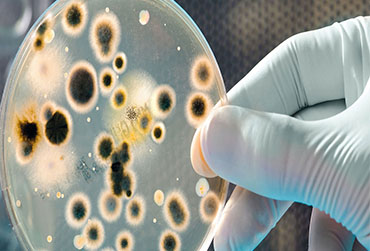 Microbiological Contamination Study and Remediation